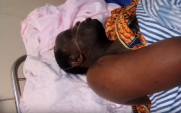 Land Probe: Mbarara Municipality Councillor Attacked With Acid