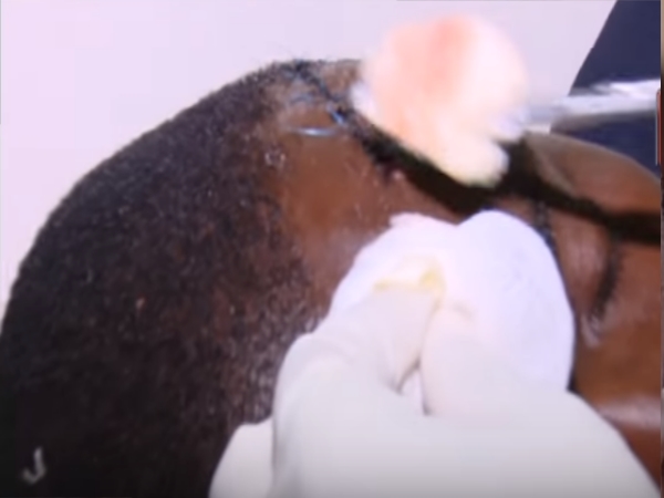 Operators Wounded In Boda-Boda Clashes Speak Out
