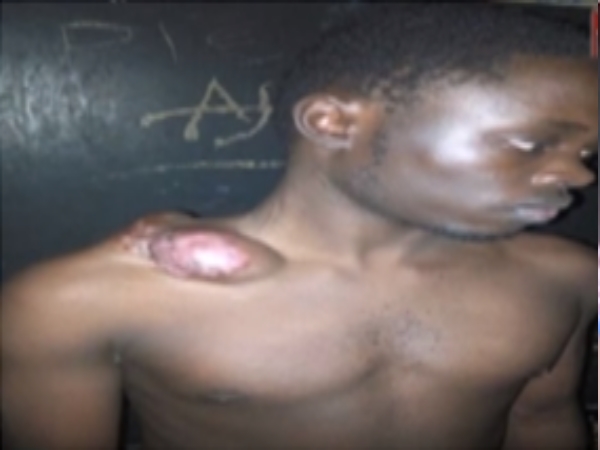 Suspect In The Kaweesi Murder Probe Held Without Trial Despite Deteriorating Health
